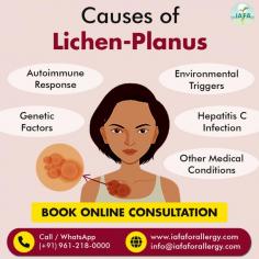 Causes of Lichen Planus