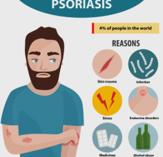 Ayurvedic Treatment for Psoriasis at Ayur Healthcare offers a holistic approach to managing this chronic skin condition. Practitioners utilize personalized assessments to understand individual triggers and symptoms, crafting tailored treatment plans that may include herbal remedies, dietary adjustments, and lifestyle changes. Ayurvedic treatments aim to reduce inflammation, enhance skin health, and promote overall balance within the body. By addressing both the physical and emotional aspects of psoriasis, individuals can experience significant relief and improvement in their skin condition, embracing the gentle healing power of Ayurveda for healthier skin.