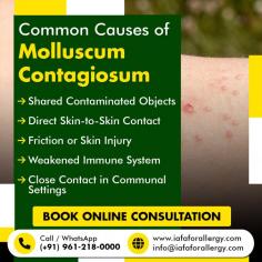 Common Causes of Molluscum Contagiosum