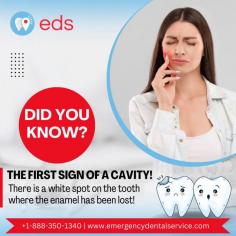 Did you know? | Emergency Dental Service

Did you know? The first sign of a cavity is a white spot on the tooth that indicates enamel loss. This early stage of tooth decay can often be treated with fluoride and proper oral hygiene. Detecting cavities at this stage helps prevent further damage and the need for unnecessary dental treatments.  Schedule an appointment at 1-888-350-1340. 