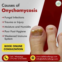 Causes of Onychomycosis