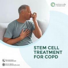 COPD is a progressive worsening condition. Living in a polluted area increases the chances of getting #COPD. If you want to fight back and halt the march of this disease, you need the body's healing system to take over. Even though medications can help for a bit, they are not enough for your body to really bounce back. 

Given all this, stem cell treatment for COPD could totally be a solid choice. So, like, there are actually studies out there that show stem cell therapy for COPD is, like, pretty effective. It’s like giving your lungs a fresh start and helping your body get back on track. 

If you're curious about stem cell therapy for COPD, hit us up at +919654321400!