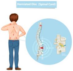 Disc Bulge specialist doctor in Hyderabad - Kaira Clinics

At Kaira Clinics, we specialize in treating disc bulge issues in Hyderabad. Our dedicated team of certified doctors uses modern technology to provide personalized care, ensuring optimal health and effective treatment for your conditions.

Visit us :- https://kairaclinics.com/departments/disc-bulge/