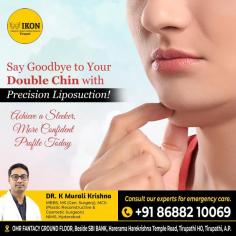 Looking to know the liposuction surgery cost in Tirupati? Get detailed insights into pricing, procedures, and expert care in Tirupati's top cosmetic clinics. Achieve your ideal look with advanced fat removal techniques and personalized treatment plans tailored to your needs.