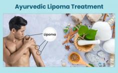 Using herbal remedies for lipoma and home remedies for lipoma can offer a natural approach to managing these benign growths. However, while these methods may help shrink small lipomas or prevent new ones from forming, they are not a guaranteed cure.