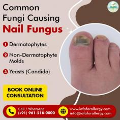 Common Fungi that Causing Nail Fungus