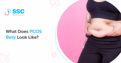 PCOS Belly Look Like: Causes, Risks, and Treatments

PCOS belly refers to the abdominal belly fat causing an increased waist-to-hip ratio, PCOS Belly will look like an apple-shaped belly.