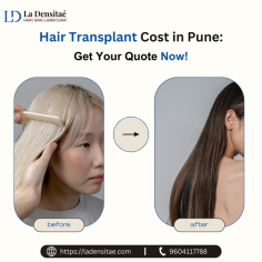 Hair transplant surgeries have become increasingly popular in India, particularly in cities like Pune, Thane, and Navi Mumbai, where individuals seek effective solutions for hair loss. As the demand for hair restoration grows, one of the most common questions prospective patients ask is: What is the hair transplant cost in Pune? In this blog, we will explore the factors that determine the cost of a hair transplant in Pune, as well as a comparison with other nearby cities like Thane and Navi Mumbai, while highlighting the key offerings of La Densitae, a renowned clinic in Pune for hair restoration.

https://medium.com/@ladensitae478/hair-transplant-costs-in-pune-whats-included-05911a95f656