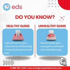 Do You Know? | Emergency Dental Service

Maintaining healthy gums is essential for overall dental health. Healthy gums are light pink, firm, and do not bleed easily. They are also firmly attached to the teeth. On the other hand, unhealthy gums may appear red, swollen, and bleed easily. They may also be loose around the teeth. Regular oral hygiene and dental check-ups ensure healthy gums and overall dental health.  Schedule an appointment at 1-888-350-1340. 