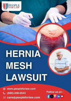 A hernia mesh lawsuit involves claims against medical device manufacturers for complications arising from defective hernia mesh implants. Patients allege that the mesh caused severe pain, infections, mesh failure, and additional surgeries. These lawsuits seek compensation for medical expenses, lost wages, and suffering due to the faulty implants. People For Law will provide clients with a legal expert to deal with the big corporations and get justice. 

