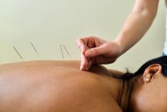 
Discover the power of holistic healing at Vertex Physiotherapy, your trusted provider of premier acupuncture therapy in Edmonton. We blend ancient wisdom with modern scientific understanding,TO More: https://vertexphysio.ca/traditional-chinese-acupuncture-edmonton/, (825) 525-2852, southclinic@vertexphysio.ca

#acupuncturephysiotherapyedmonton #acupuncturerehabilitationedmonton #acupuncturephysiotherapy #southedmonton #physopthrapyedmonton #granvillephysopthrapyedmonton