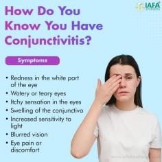 Symptoms of Allergic Conjunctivitis