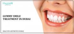 Achieve a confident smile with advanced gummy smile treatment in Dubai. Trust Dr. OBT at Halcyon Aesthetics for exceptional and precise results.