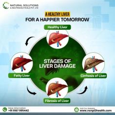 The final and most serious phase of liver diseases caused by fatty tissue. In this stage, the damage is irreparable as scar tissue overwhelms the liver and limits its capacity to function effectively. There are signs including abdominal swelling, extreme fatigue or jaundice. When this happens the need for medical attention becomes crucial. Although preventing cirrhosis can be managed but the primary focus is slowing the progression of damage and controlling the symptoms.

Know more: https://www.nsnpl2health.com/hepadetox/
