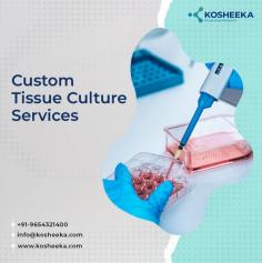 Kosheeka offers Custom Tissue Culture Services tailored to meet the unique requirements of research professionals working in basic and application-oriented science. As a leader in cell manufacturing, we specialize in primary cells developing services, producing high-quality biomaterials under GMP-compliant, BSL-2-certified conditions. 

Our offerings include human liver hepatocytes, which are conveniently shipped every fortnight for efficient research timelines. Additionally, we provide mouse primary cells, including mesenchymal stem cells, and biofluids using cruelty free methods, ensuring a wide range of high-quality biological materials for your research. 

With Kosheeka, you can rely on standardized, ethically sourced biomaterials that are developed to support cutting-edge scientific investigations, from drug discovery to regenerative medicine.

https://www.kosheeka.com/custom-solutions/
