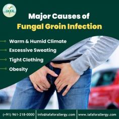 Major Causes of Fungal Groin Infection