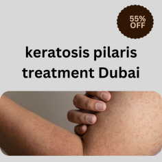 Discover the ultimate keratosis pilaris treatment Dubai at Halcyon Aesthetics Dubai, led by renowned dermatologist Dr. Osman Tahir Bashir (Dr. OBT). Say goodbye to rough, bumpy skin with our advanced solutions tailored to address keratosis pilaris effectively. Whether you’re struggling with stubborn kp skin or seeking reliable kp treatment, we provide cutting-edge therapies and personalized care.

Our team specializes in innovative keratosis pilaris treatment, offering the best medicine for keratosis pilaris to ensure smooth, healthy skin. At Halcyon Aesthetics, we focus on comprehensive kp skin treatment to resolve your concerns. Learn more about our exceptional k pilaris treatment methods and why we are a top choice for managing keratosis p.

Visit our website for the best solutions in pilaris treatment and let us guide you toward a confident, radiant appearance. Trust Halcyon Aesthetics Dubai and Dr. OBT for unparalleled results in treating keratosis pilaris.