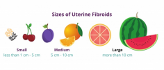 Wondering which size of fibroid is normal? Learn about fibroid growth, how size impacts symptoms like heavy bleeding or pain, and when to seek medical advice. Understand what’s typical and what’s not. 