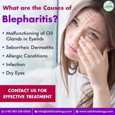 Causes of Blepharitis