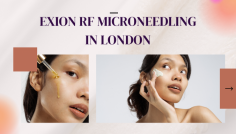 Rejuvenate your skin with Exion RF in London Microneedling at Halcyon Medispa and Wellness. Led by the skilled Dr. Obt, our innovative treatments are tailored to restore your skin’s smoothness, firmness, and radiant glow.