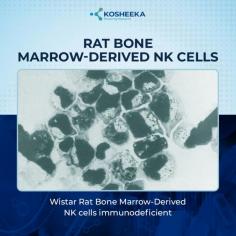 Did you know that bone marrow-derived NK cells are identified to be the frontline soldiers in targeting and destroying growing tumors? From studying in vitro cytotoxicity to in vivo tumor regression Bone Marrow-derived NK cells obtained from immunodeficient Wistar rats can help you get new insights into the world of immunotherapies. 

Visit us to know more! https://www.kosheeka.com/product/rat-bone-marrow-derived-nk-cells-wistar/
